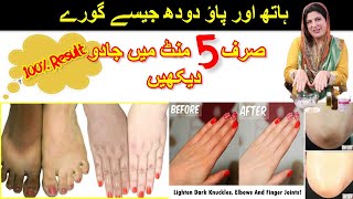 INSTANT HANDS FEET KNUCKLES WHITENING in 5 MINUTES in URDU  HINDI  DR BILQUIS SHAIKH [upl. by Patterman]