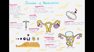 Menstruation  Physiology and Disorders Amenorrhea Oligomenorrhea Hypermenorrhea Dysmenorrhea [upl. by Hedwiga]