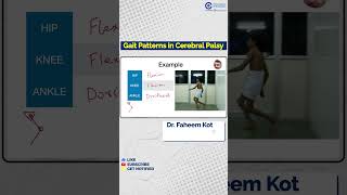 Dr Faheem Kotekar Explains Gait Patterns in Cerebral Palsy  Conceptual Orthopedics [upl. by Enyamrahs]