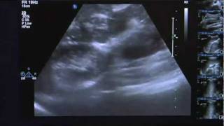 Ultrasound Training Gastrointestinal Tract [upl. by Nehtanoj]