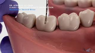 Class I compound cavity preparation  mandibular molar  Preclinical Operative  Arabic عربي [upl. by Alleuqram748]