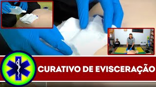 EVISCERAÇÃO no APH como fazer o curativo APH e primeiros socorros [upl. by Tchao]