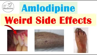 Amlodipine Weird Side Effects Skin Gastrointestinal Psychological [upl. by Julio96]