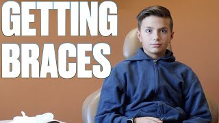 GOING TO THE ORTHODONTIST FOR THE FIRST TIME  WHAT TO EXPECT AT THE ORTHODONTIST  GETTING BRACES [upl. by Landon190]