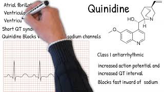 Quinidine uses and side effects  Explained simply quinidine ecg [upl. by Erlewine571]