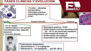 ¿Qué es la enfermedad de Chagas  Titulares con Vianey Esquinca [upl. by Hildie]