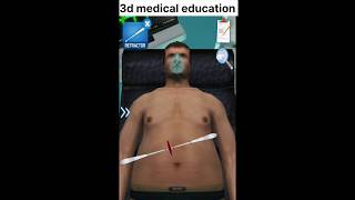 3d open kidney surgery in best animation video [upl. by Yecnay]