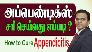 அப்பெண்டிக்ஸ் சரி செய்வது எப்படி HOW TO CURE APPENTICITIS Laparoscopy Surgery [upl. by Nyberg]