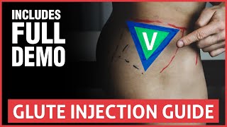 How To Do A Glute Injection  Full Guide And Demo [upl. by Mllly]