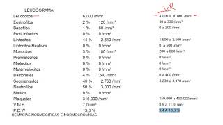 AULA 03 LEUCOGRAMA E PLAQUETOGRAMA [upl. by Gudrin193]