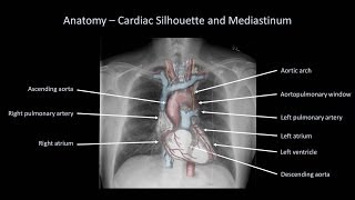 How to Interpret a Chest XRay Lesson 2  A Systematic Method and Anatomy [upl. by Gavriella]