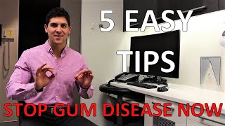 HOW TO STOP GUM DISEASE AND BLEEDING AT HOME Fix Gingivitis And Gum Pain 5 Simple Steps [upl. by Maffa]