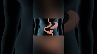 Sleeve Gastrectomy medicalanimation health shorts [upl. by Anhoj]