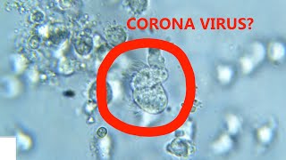 CORONAVIRUS BAJO MICROSCOPIO  CORONA VIRUS MICROSCOPE QUE MIEDO OMG [upl. by Abihsot]