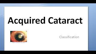 Ophthalmology 191 Acquired Cataract Classification Types Causes Reason prevent Complicated Metabolic [upl. by Nnylacissej]