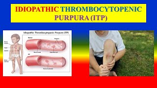 IDIOPATHIC THROMBOCYTOPENIC PURPURA  ITP   definition  types  pathophysiology  management [upl. by Jaban]