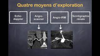 Sténose de lartère rénale  1 Généralités [upl. by Nassi332]