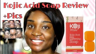 SKIN LIGHTENING SOAP Koji White Kojic Acid Skin Lightening Soap Review  BeautyByAJ [upl. by Estis]