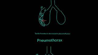 Tactile Fremitus Explained [upl. by Aseiram532]