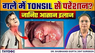 गले में दर्द सूजन से परेशान  जानिए Tonsil के कारण और इलाज  Tonsillitis Treatment and Causes [upl. by Dulciana115]