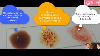 How to test to know ABO Blood group and Rh Typing by RJH  Medical video  RJ Harish [upl. by Zerimar]