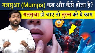 गलसुआ Mumps क्यों हो जाता है  गलसुआ हो जाते तो तुरंत करें ये काम ViralKhanSir [upl. by Hole578]