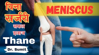 बिना ऑपरेशन 3 Rd Grade Meniscus Tear का सफल इलाज Without Surgery In Thane  Dr Sumit Vishwakarma [upl. by Nieberg390]