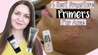 Best Drugstore Primers For Acne Prone Skin 2019  Noncomedogenic Primers [upl. by Ahsener]