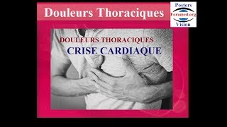 Reconnaitre une crise cardiaque des autres douleurs thoraciques symptomes [upl. by Otto71]