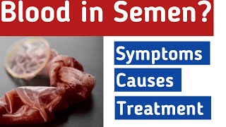 Blood In semen Haematospermia  Causes Symptoms Diagnosis Treatment  Dr Khalil Ur Rehman [upl. by Kitti807]