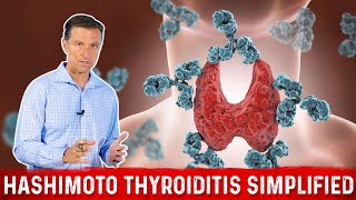 Hashimoto Thyroiditis Autoimmune Hypothyroid Simplified by Dr Berg [upl. by Brosy]