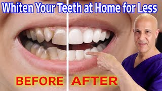 Whiten Your Teeth at Home for Nearly Free Dr Mandell [upl. by Thatcher]