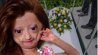 RIP Youtuber Adalia Rose Died Last Moment With her Mother😭This is so sd [upl. by Rozalie596]