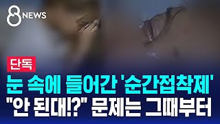 단독 눈 속에 들어간 순간접착제…quot안 된대quot 문제는 그때부터  SBS 8뉴스 [upl. by Lammaj]