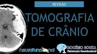 TOMOGRAFIA DE CRÂNIO Vídeo Aula  Rogério Souza [upl. by Haywood524]