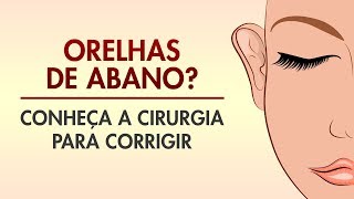 OTOPLASTIA ORELHA DE ABANO COMO É FEITA DREAM PLASTIC  CIRURGIA PLÁSTICA [upl. by Anu]