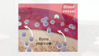 Stem Cell PreCollection and Mobilization [upl. by Vastha]