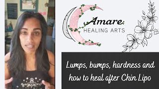 Lumps bumps hardness and how to heal after Chin Lipo [upl. by Yesdnil]