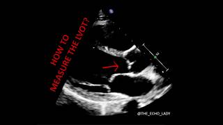 ECHOCARDIOGRAPHY How to measure the LVOT [upl. by Iram591]