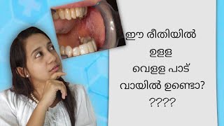 ഈ രീതിയിൽ ഉളള വെളള പാട് വായിൽ ഉണ്ടൊ ORAL LICHEN PLANUS white patch mouth malayalam oral cancer [upl. by Anoi]