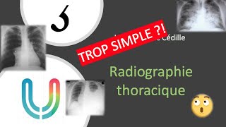 Urgences  la lecon avec cedille  radiographie thoracique 🩻 [upl. by Lorak]