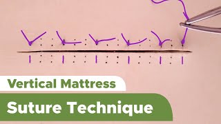 Suture Techniques and Training Series Interrupted Vertical Mattress Suture Technique [upl. by Healy]