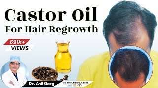 Is Castor Oil Good For Hair Growth  बाल Regrowth के लिए Castor Oil का उपयोग करे  Dr Anil Garg [upl. by Nyllij]