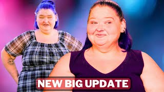 quotShocking Update on Amy Slatons Bruising in 1000Lb Sisters 😱  Heartbreaking News Revealedquot [upl. by Ecilahc]