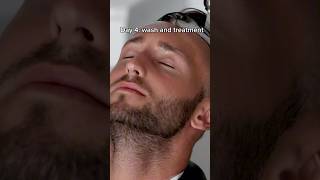 INSANE HAIR TRANSPLANT EXPERIENCE [upl. by Dnalyag]