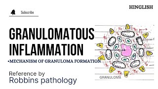 Granulomatous Inflammation  Granuloma formation  Mechanism of Granuloma formation  KTC MBBS [upl. by Annekim]