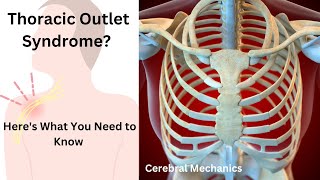 Thoracic Outlet Syndrome The Exercises You NEED To Know [upl. by Naihtniroc823]