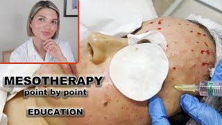 Mesotherapy for face full demo and point by point injection technique [upl. by Turmel]