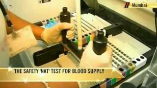 What is Nucleic Acid Test [upl. by Reiter]