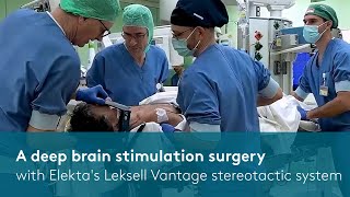 A DBS surgery with Elektas Leksell Vantage stereotactic system [upl. by Corrianne]